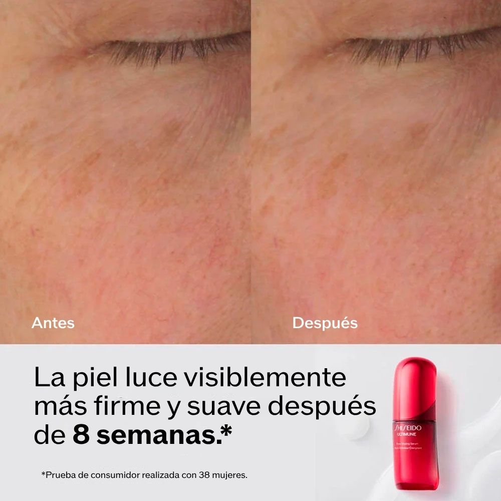 ULTIMUNE POWER INFUSING SERUM (S&Eacute;RUM ANTI- EDAD)